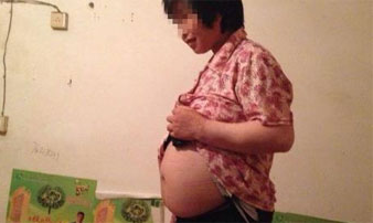 成都精神病医院